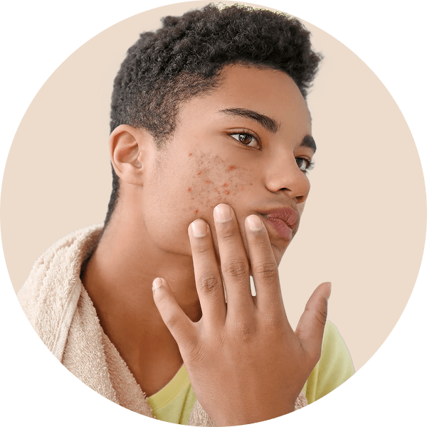 Chica Loca skincare products for nourished, hydrated glow – Vitamin C Serum and Anti Pigmentation Facewash