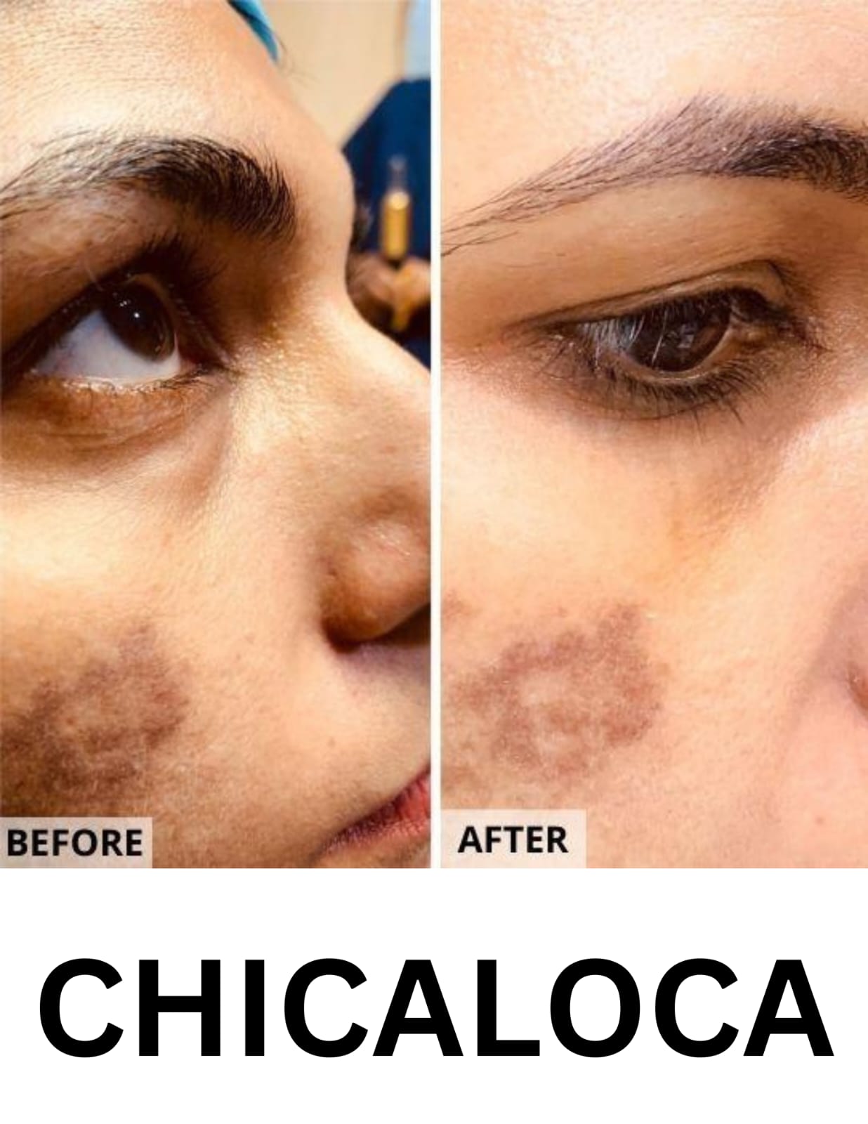 Discover the Best Creams and Face Washes for Skin Pigmentation