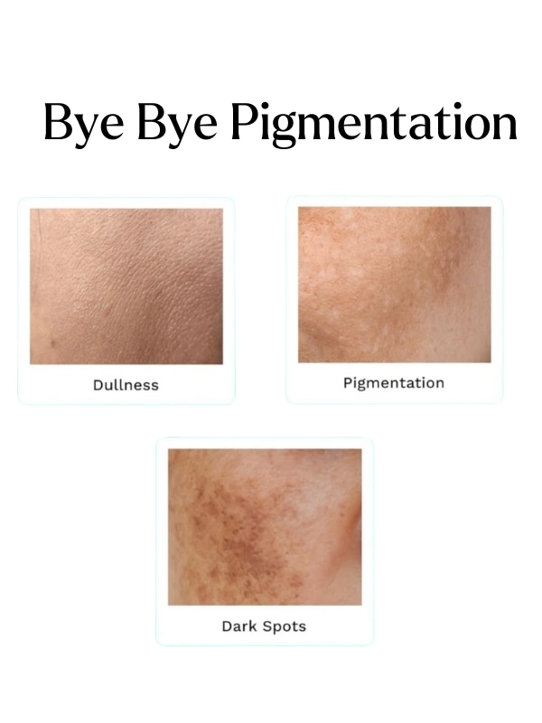 Anti Pigmentation facewash and cream for all type of skin reduce dullness pigmentation and dark spots