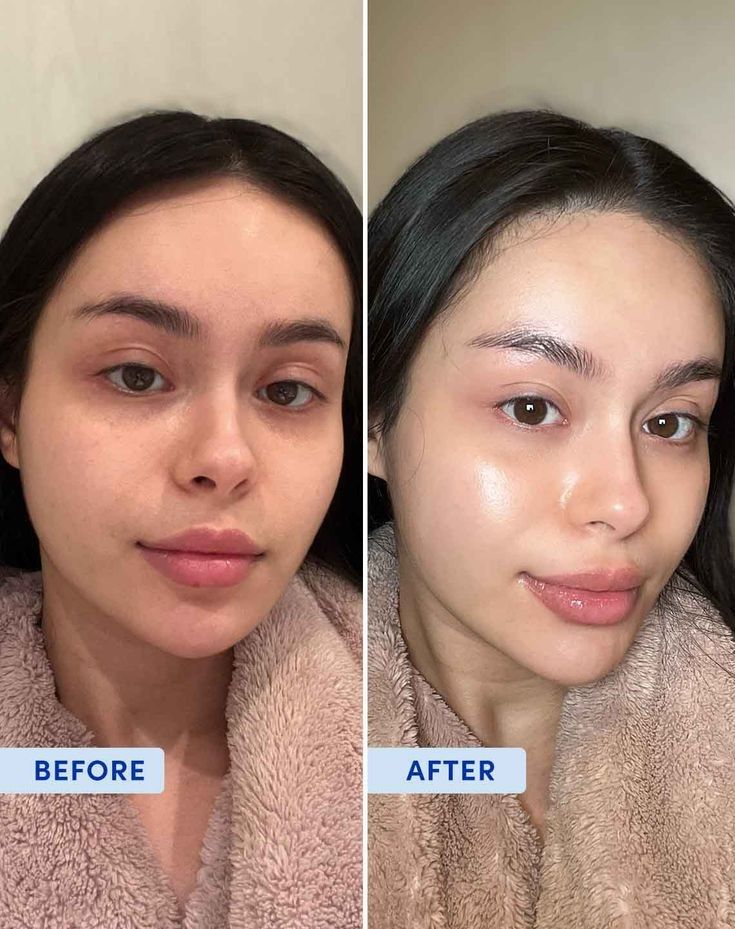Vitamin C and Niacinamide skincare routine Chica-Loca – facewash, toner, serum, moisturizer and sunscreen SPF 50