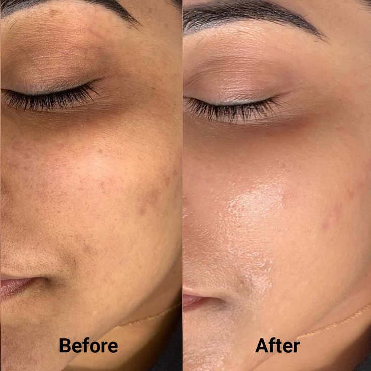 vitamin c face serum for all kin type by chica loca
