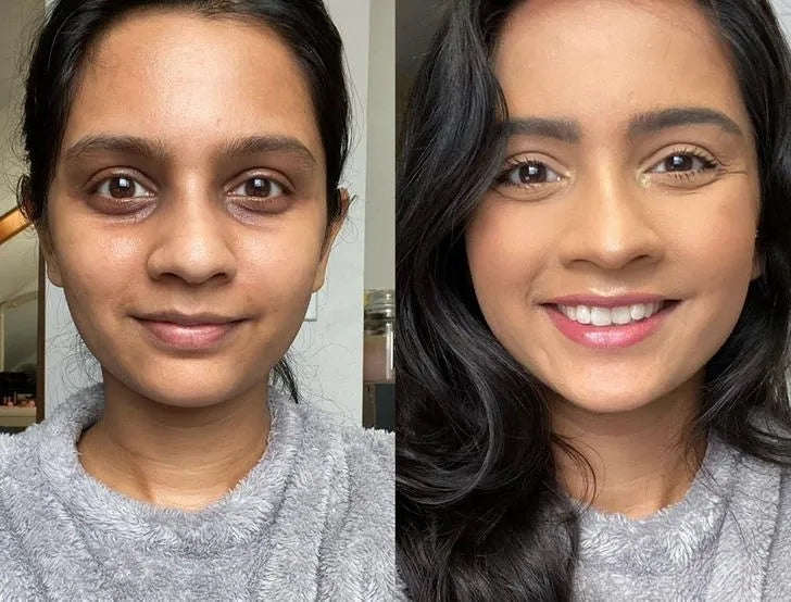 before and after using chicaloca vitamin c serum & sunscreen & d tan facewash brighter glowing and even kin tone